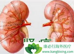 ��������/���������ܸ����������ߵ�Ԥ����