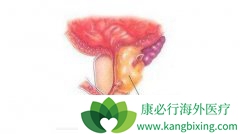 ��������ǰ���ٰ�֢״������Щ