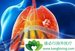 PD-1���Ƽ���PD-L1���Ƽ��ڰ�ȫ������ʲô����