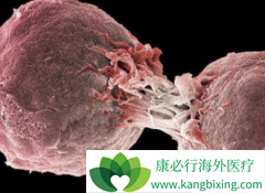 t���ܰ�������ʲô����ģ�t���ܰ������Ʒ�������Щ��