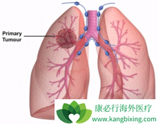 �ΰ�������������Щ��Сϸ���ΰ�����