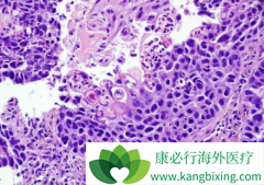 ��ͬ�����͵ķ���״ϸ��������ҩ��Ҳ��һ��