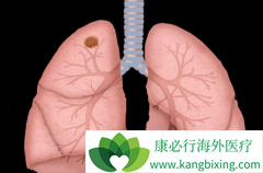 ���˻������Ʒΰ��ķ�������ʲô����ʲô���ƣ�