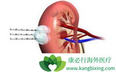 ��άĪ˾(Everolimus)����������������ҩ����