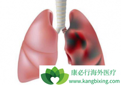 �˽����ڷΰ�֢״�Էΰ������ƺ���Ҫ