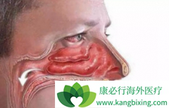 ��PD-1/PD-L1���߼���Ϊ����������ҩ��ı��˱��ʰ����ƾ���