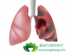 ������֢״��Сϸ���ΰ���ת�Ƶķ�������Щ