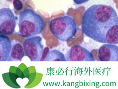 ���׿����ں����Ķ෢�Թ�����֢״