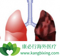 ��������(afatinib)��һ���ΰ�ҩ������ǿ�ȸ���