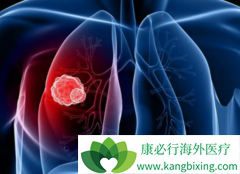 �ΰ�ҩ��������(Dacomitinib)���й���������