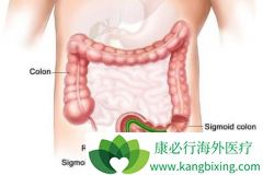 �����������ƺ��չ�Ľ�ֱ�������߿ɷ��ð�������