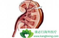 �������ὺ��(Cometriq)�����������ı�׼����ҩ�����Ч