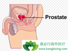 ��������(Cometriq)����Ч����С���ǰ���ٰ�