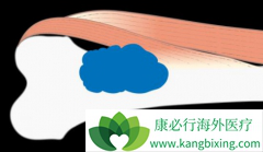 ���ܵ�ŵ����(SGEVA)���ƵĻ��߷���ԭ���Զ��������ļ��ʸ���