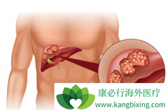 ������������atezolizumab�������ڳ���ΰ����ٴ��о�