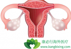 �ѳ�������ʹ��PARP���Ƽ��᲻�������ҩ