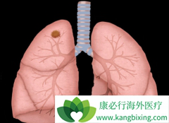 ���ڷ�Сϸ���ΰ�������EGFR-TKI�л�����