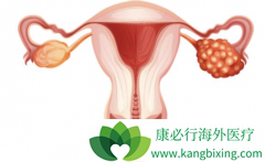 BRCAͻ������������(ZEJULA)���ƻ������������