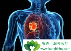 Ŀǰ����ALK���Էΰ��İ���ҩ������Щ����Ч֮����ʲô����