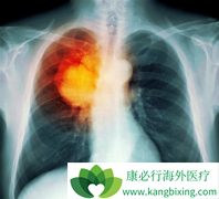 ʲô�Ƿΰ����ƣ�Сϸ���ΰ�����ʱҪע��Щʲô��