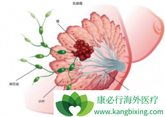 ���������HER2�������ٰ��ĺ�������������