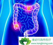 ��������(Avastin)���Ϸ���ऺ������濵��RASҰ���ͽ�ֱ����������