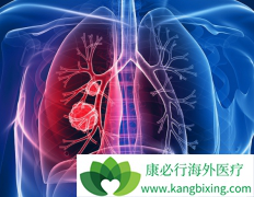 PD-1���ϻ���ҩ�������ض����ͷΰ�ʱ����50%�Ŀ͹ۻ�����