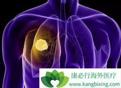 ����ҩ����������(Lorlatinib)��Ч�Կ��ΰ���ת��