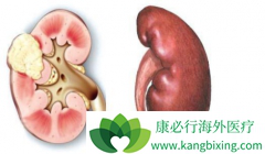 ������������ҩ�￨������ĸ�����������