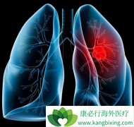 �߱���Щ������ALK���Էΰ����߿�ʹ����������(Lorlatinib)��