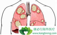 �ϲ���ת�Ƶ�EGFRͻ���Сϸ���ΰ���ѡ����ҩ�ﻹ����������