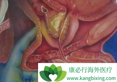 ǰ���ٰ�ҩ�����³���ܹ������ӳ����ٰ�������λ�������