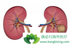 �������������ļ���TKI��ҩ�����