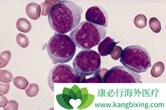 ��Щ����ͻ�����͵İ�Ѫ�����߶���³�����������ǿ��