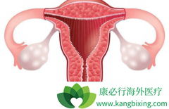 Ϊ��PARP���Ƽ�����ŷ��������ά�������ѳ�������Ӧ֢��