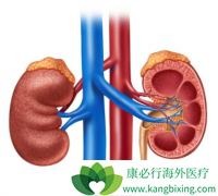 Tivozanib�ɽ������������ߵ��޽�չ���������44%