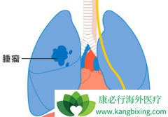 �����������������Щ����ͻ��ķ�Сϸ���ΰ���