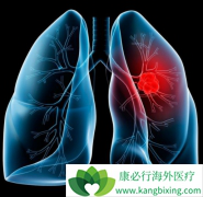 �����������ƿ������ڷΰ����ߵ����������½�32%