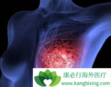 ���ٰ����Ʒ�����ôѡ��CDK4/6���Ƽ��������������ٰ���ҩ��