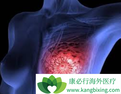 乳腺癌 乳腺癌
