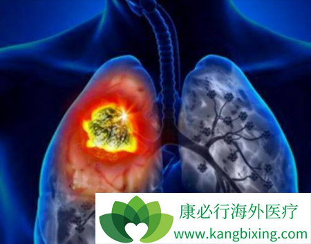 劳拉替尼 劳拉替尼