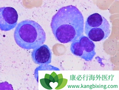 Daratumumab���Ƴ���෢�Թ�����Ч����ô����