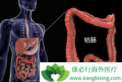 ���ڽ�ֱ������������������Ч��Ԥ����������Щ��