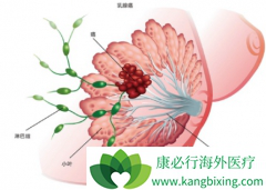 �ӳ����㻯ø���Ƽ�����ʱ���Ԥ���Բ����ٰ��ķ���