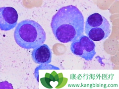 �ٴ��϶෢�Թ�����֢״���Ӷ���