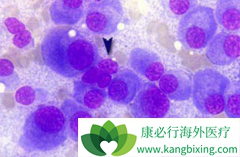 �����Ȱ�����elotuzumab�ɽ��Ͷ෢�Թ��������ߵ���������