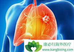 ����ALK���Էΰ��İ���ҩ�����ĸ�����Ч����ã�