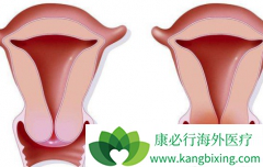 �������þ��β���Ҳ���������ڹ�����֢״����