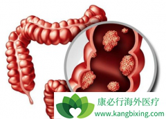 �󳦰�֢״֮һ��Ѫ���̴���Ѫ�кβ�ͬ��