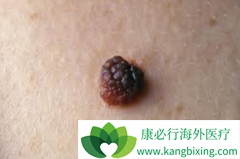 PD-1�����ں�ɫ�����е��о���������Щ��